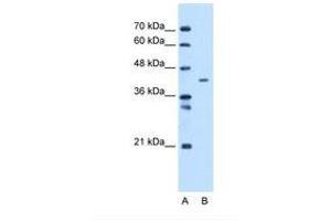Image no. 1 for anti-Mitochondrial Carrier 1 (MTCH1) (C-Term) antibody (ABIN6738296) (MTCH1 Antikörper  (C-Term))