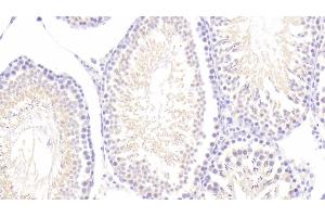 Detection of MAP2 in Rat Testis Tissue using Polyclonal Antibody to Microtubule Associated Protein 2 (MAP2) (MAP2 Antikörper  (AA 1459-1718))