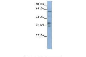 Image no. 1 for anti-Centromere Protein B (CENPB) (AA 506-555) antibody (ABIN6738799) (CENPB Antikörper  (AA 506-555))