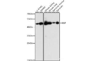 Western blot analysis of extracts of various cell lines using IBSP Polyclonal Antibody at dilution of 1:1000. (IBSP Antikörper)
