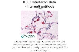 Image no. 1 for anti-Interferon, beta 1, Fibroblast (IFNB1) (Internal Region) antibody (ABIN1735973) (IFNB1 Antikörper  (Internal Region))