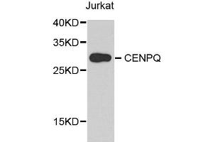 Western blot analysis of extract of various cells, using CENPQ antibody.