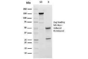 SDS-PAGE Analysis Purified C1QA Mouse Monoclonal Antibody (C1QA/2952). (C1QA Antikörper  (AA 104-237))