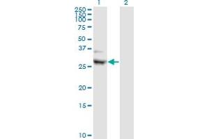 Western Blot analysis of CIDEA expression in transfected 293T cell line by CIDEA monoclonal antibody (M01), clone 4B9.
