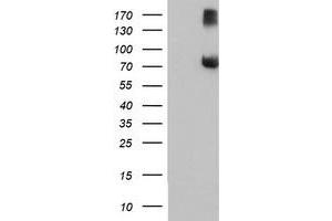 Western Blotting (WB) image for anti-F-Box Protein 21 (FBXO21) antibody (ABIN1498238) (FBXO21 Antikörper)