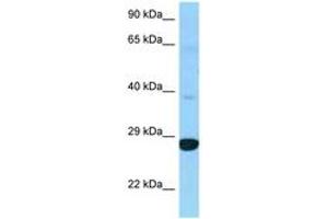 Image no. 1 for anti-Dehydrogenase/reductase (SDR Family) Member 4 Like 2 (DHRS4L2) (C-Term) antibody (ABIN6748237) (DHRS4L2 Antikörper  (C-Term))