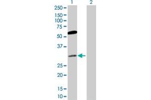 Western Blot analysis of CACYBP expression in transfected 293T cell line by CACYBP MaxPab polyclonal antibody. (CACYBP Antikörper  (AA 1-228))
