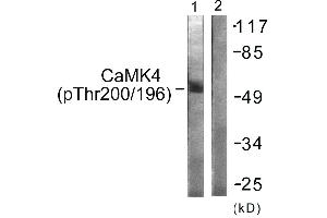 Immunohistochemistry analysis of paraffin-embedded human brain tissue using CaMK4 (Phospho-Thr196/200) antibody. (CAMK4 Antikörper  (pThr196, pThr200))