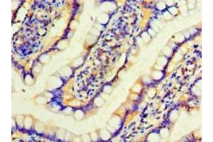 Immunohistochemistry of paraffin-embedded human small intestine tissue using ABIN7156569 at dilution of 1:100 (IFNA4 Antikörper  (AA 24-189))
