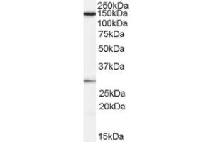 Image no. 1 for anti-FACT complex subunit SPT16 (SUPT16H) (Internal Region) antibody (ABIN374777) (SUPT16H Antikörper  (Internal Region))
