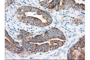 Immunohistochemical staining of paraffin-embedded Human liver tissue using anti-KHK mouse monoclonal antibody. (Ketohexokinase Antikörper)