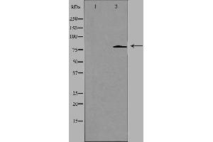 Western blot analysis of extracts from LOVO cells using CHSS2 antibody. (CHPF Antikörper  (C-Term))