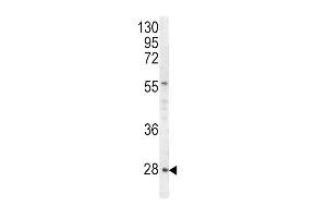 Western blot analysis of HPRT1 antibody (C-term) (ABIN390692 and ABIN2840982) in Hela cell line lysates (35 μg/lane). (HPRT1 Antikörper  (C-Term))