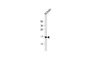 Anti-CPLX1 Antibody (Center) at 1:1000 dilution + mouse brain lysate Lysates/proteins at 20 μg per lane. (Complexin 1 Antikörper  (AA 33-60))
