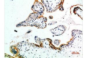 Immunohistochemistry (IHC) image for anti-Endothelin Receptor Type B (EDNRB) (AA 31-80) antibody (ABIN7180300)