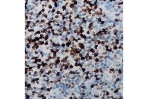Immunohistochemical analysis of CCNB1IP1 staining in human lymph node formalin fixed paraffin embedded tissue section. (CCNB1IP1 Antikörper  (C-Term))