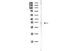 anti-Sirtuin 5 (SIRT5) (Internal Region) antibody
