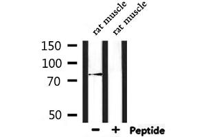 Western Blotting (WB) image for anti-Leucine Rich Repeat and Sterile alpha Motif Containing 1 (LRSAM1) (Internal Region) antibody (ABIN6263013)