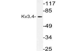 Western blot (WB) analysis of Kv3. (Kv3.4 Antikörper)