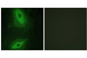 Immunofluorescence analysis of HeLa cells, using TNFSF15 antibody. (TNFSF15 Antikörper  (C-Term))