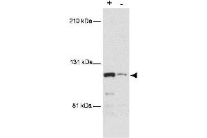 Western blot using  anti-MTBP antibody shows detection of a band ~110 kDa corresponding to human MTBP (arrowhead). (MTBP Antikörper  (AA 667-812))