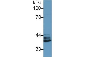 Detection of IRF1 in Human Jurkat cell lysate using Polyclonal Antibody to Interferon Regulatory Factor 1 (IRF1) (IRF1 Antikörper  (AA 44-319))