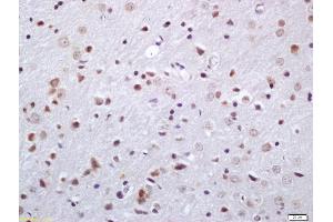 Formalin-fixed and paraffin embedded rat brain labeled with Anti-Phosphoserine/threonine Polyclonal Antibody, Unconjugated (ABIN1385068) at 1:200 followed by conjugation to the secondary antibody and DAB staining (Phosphoserine/Threonine (phosphorylated) Antikörper)