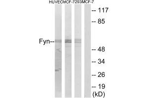 Western blot analysis of extracts from HUVEC cells, MCF-7 cells and 293 cells, using Fyn (epitope around residue 530) antibody. (FYN Antikörper  (Tyr530))