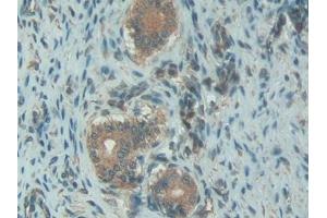 Immunohistochemistry (IHC) image for anti-Serpin Peptidase Inhibitor, Clade G (C1 Inhibitor), Member 1 (SERPING1) (AA 148-270) antibody (ABIN7431434)