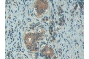 Detection of C1INH in Rat Uterus Tissue using Polyclonal Antibody to Complement 1 Inhibitor (C1INH) (SERPING1 Antikörper  (AA 148-270))