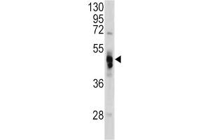 Western Blotting (WB) image for anti-Galactosidase, alpha (GLA) antibody (ABIN3002776) (GLA Antikörper)