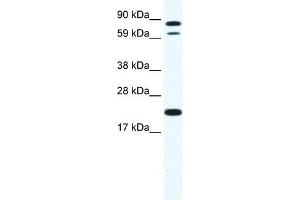 Western Blot showing ZFP287 antibody used at a concentration of 1-2 ug/ml to detect its target protein.