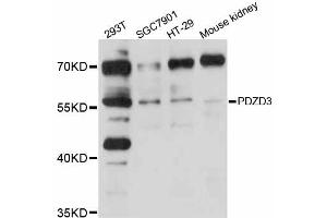 Western blot analysis of extracts of various cell lines, using PDZD3 antibody (ABIN5998488) at 1/1000 dilution. (PDZD3 Antikörper)