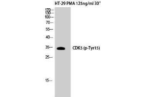 Western Blotting (WB) image for anti-Cyclin-Dependent Kinase 5 (CDK5) (pTyr15) antibody (ABIN3179551) (CDK5 Antikörper  (pTyr15))