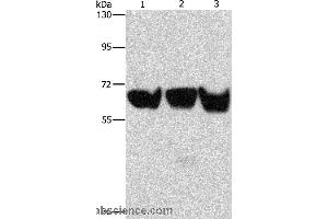 Western blot analysis of 293T, PC3 and hela cell, using ADRA1B Polyclonal Antibody at dilution of 1:500 (ADRA1B Antikörper)