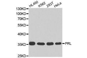 Western blot analysis of extracts of various cell lines, using PRL antibody. (Prolactin Antikörper  (AA 29-227))