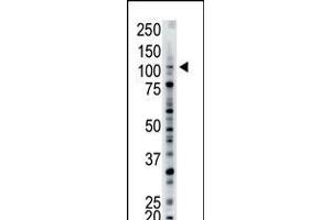 Antibody is used in Western blot to detect USP15 in mouse brain tissue lysate. (USP15 Antikörper  (N-Term))
