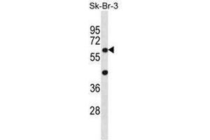STXBP3 Antibody (Center) western blot analysis in SK-BR-3 cell line lysates (35µg/lane). (STXBP3 Antikörper  (Middle Region))