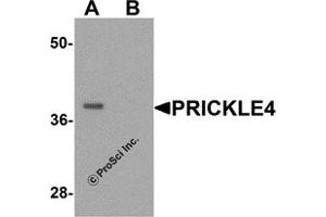 Western Blotting (WB) image for anti-Prickle Homolog 4 (PRICKLE4) (N-Term) antibody (ABIN1077371) (PRICKLE4 Antikörper  (N-Term))