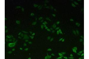 Detection of CYP1A2 in Hela cells using Polyclonal Antibody to Cytochrome P450 1A2 (CYP1A2) (CYP1A2 Antikörper  (AA 192-444))