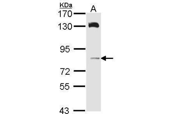 HPS6 Antikörper  (Internal Region)