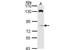 WB Image Sample (30 ug of whole cell lysate) A: A431 , 7. (HPS6 Antikörper  (Internal Region))