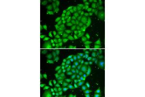 Immunofluorescence analysis of U2OS cells using TCL1A antibody (ABIN5970229). (TCL1A Antikörper)