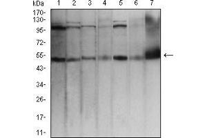 Western blot analysis using TFAP2A mouse mAb against Hela (1), MCF-7 (2), Cos7 (3), A431 (4), HCT116 (5), NIH/3T3 (6), and PC12 (7) cell lysate. (TFAP2A Antikörper  (AA 1-100))