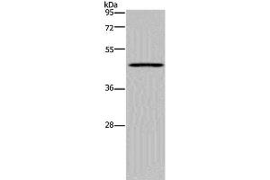 Western Blot analysis of Mouse lung tissue using MECP2 Polyclonal Antibody at dilution of 1:300 (MECP2 Antikörper)