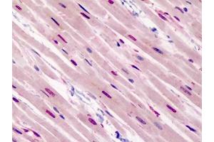 Human Heart: Formalin-Fixed, Paraffin-Embedded (FFPE) (GATA3 Antikörper  (N-Term))