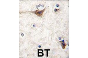Immunohistochemistry (IHC) image for anti-Cadherin 10, Type 2 (T2-Cadherin) (CDH10) (AA 25-55), (N-Term) antibody (ABIN5535227)