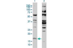 Western Blot analysis of H3F3B expression in transfected 293T cell line by H3F3B monoclonal antibody (M01), clone 2D7-H1.