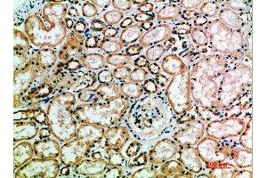 Immunohistochemical analysis of paraffin-embedded human-kidney, antibody was diluted at 1:200