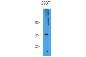 The 293T cell lysate (40 ug) were resolved by SDS-PAGE, transferred to PVDF membrane and probed with anti-human AKR7A3 antibody (1:1000). (AKR7A3 Antikörper)